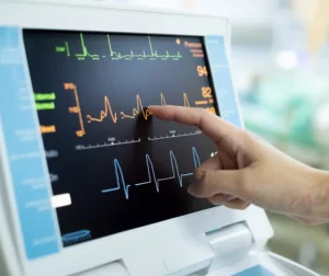 EKG test