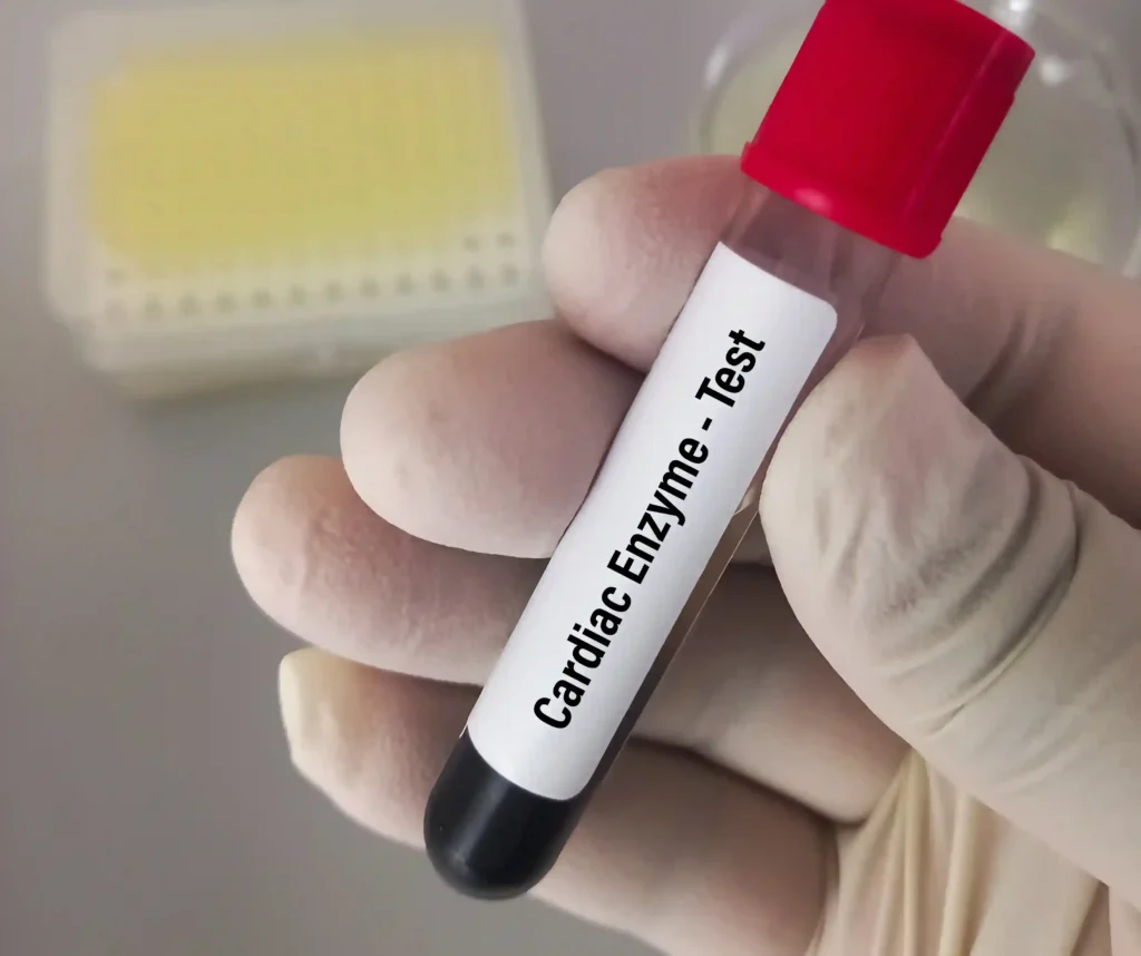 Cardiac Enzyme Testing